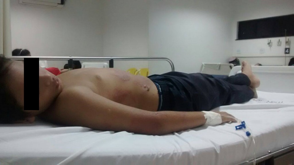 Criança sendo medicada na UPA da Cidade Operária, após ser queimada em ônibus