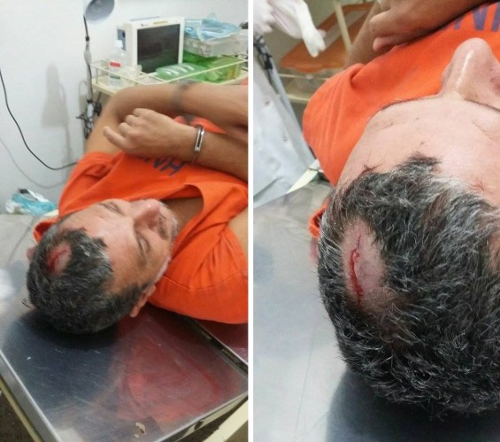 O interno Nivaldo Queiroz Galvão, que teve a cabeça quebrada no primeiro espancamento sofrido na unidade prisional psiquiátrica, há cerca de dois meses